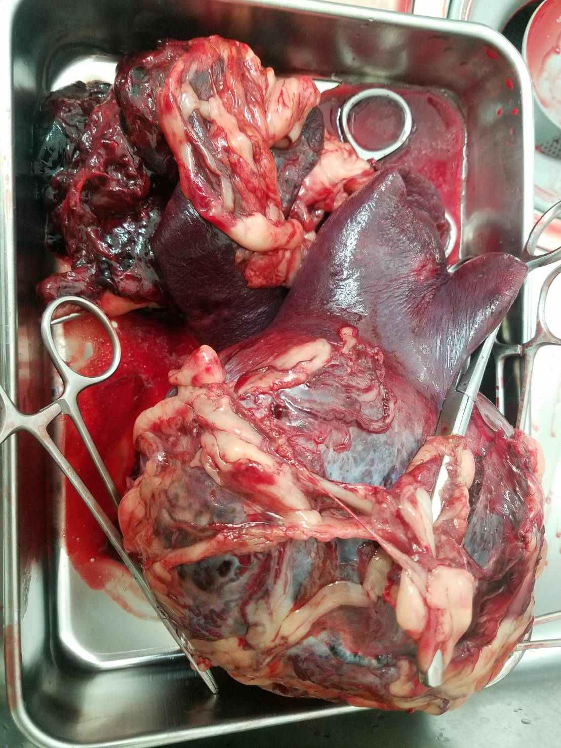 血管肉腫４