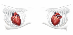 心臓の検査って何をするの？　心雑音がある子の検査について